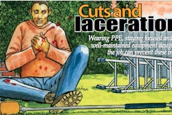 Cuts Lacerations Safety Watch
