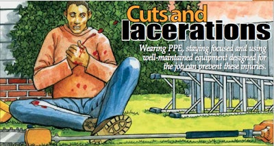 Cuts Lacerations Safety Watch