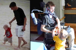 David Williams before and after his accident in 2011. Photo: Saltz, Mongeluzzi, Barrett & Bendesky, P.C.