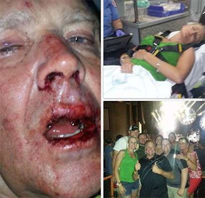 Photos of Mike and his daughter that he shared on Facebook after being attacked. Photo: Mike Wallace