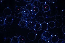 Male honeybees’ sperm, seen here under a microscope, declined nearly 40 percent after exposure to neonics. Photo: Lars Straub, University of Bern