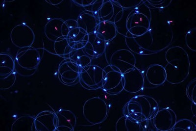 Male honeybees’ sperm, seen here under a microscope, declined nearly 40 percent after exposure to neonics. Photo: Lars Straub, University of Bern