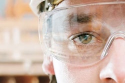 Eye injuries are easily avoidable by wearing the proper protection. Photo: workingperson.me