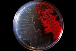 A culture plate shows the colorless bacterium Serratia marcescens strain sicaria (left) and another type of bacteria (right). Photo: University of Wisconsin-Stout