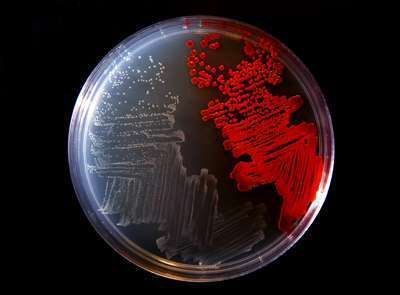 A culture plate shows the colorless bacterium Serratia marcescens strain sicaria (left) and another type of bacteria (right). Photo: University of Wisconsin-Stout